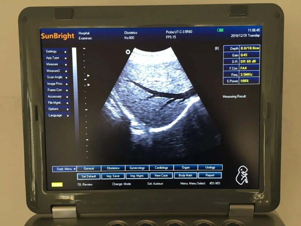 15 Inch LED Cardiac Ultrasound Echocardiography 3D 4D Laptop Ultrasound