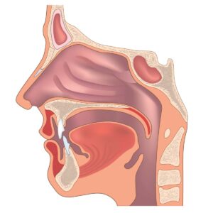 ENT (Ear, Nose, and Throat)